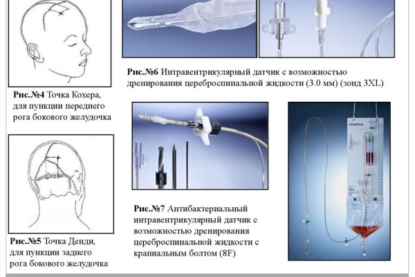 Не могу зайти на кракен